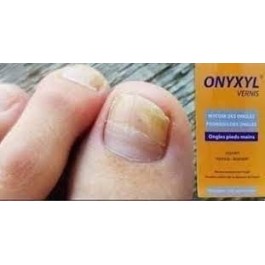 ONYXYL – Vernis de traitement des ongles | BigPara Tunisie