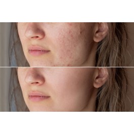 CICAMAX Reparateur Creme à l’Huile de Sesame 30 ML | BigPara Tunisie