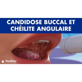 DACTAGEL MYCOSES BUCCALES PÉRLÈCHE  Tube 30 g | BigPara Tunisie