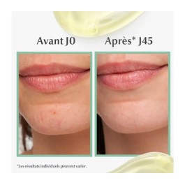 EUCERIN DERMOPURE SERUM TRIPLE ACTION 40ML | BigPara Tunisie